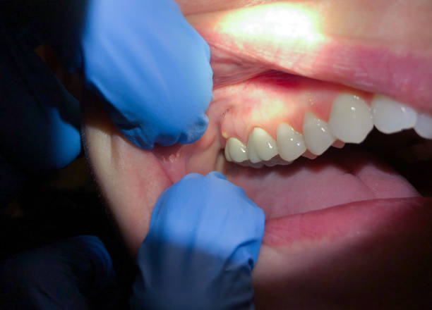 Best Emergency Root Canal Treatment in Center Line, MI