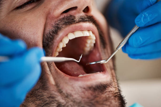 Best Holiday Emergency Dentist in Center Line, MI