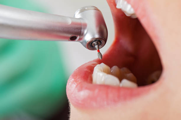 Best Orthodontic Emergency Dentist in Center Line, MI